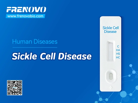 Sickle Cell Screen Rapid Test Kit